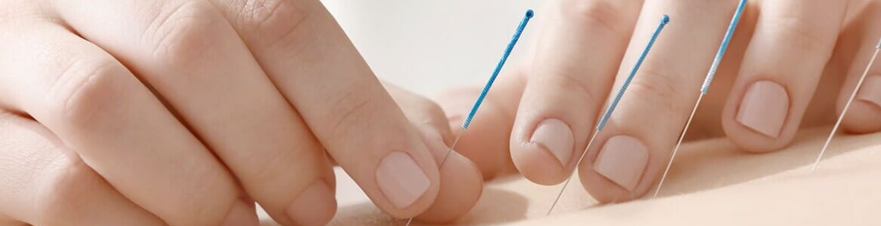 acupuntura acupuntura